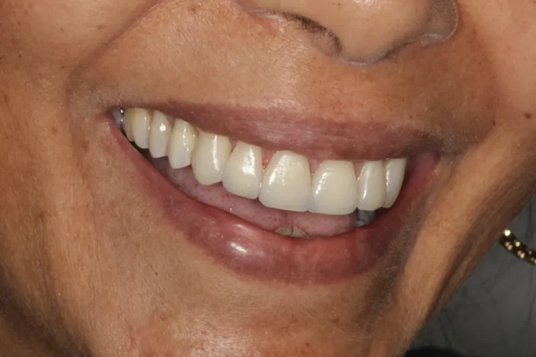 Hugo Carvalho Reabilitação Oral e Estética