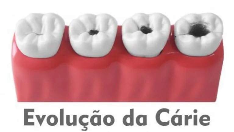 Hugo Carvalho Reabilitação Oral e Estética