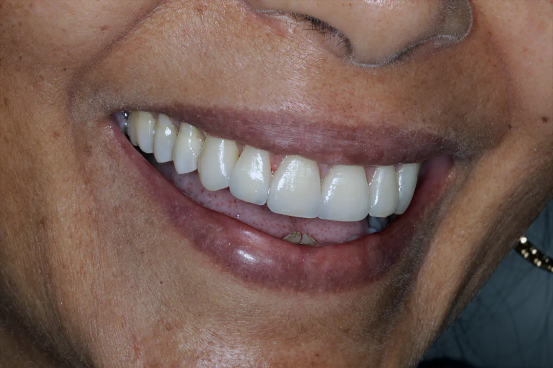Hugo Carvalho Reabilitação Oral e Estética