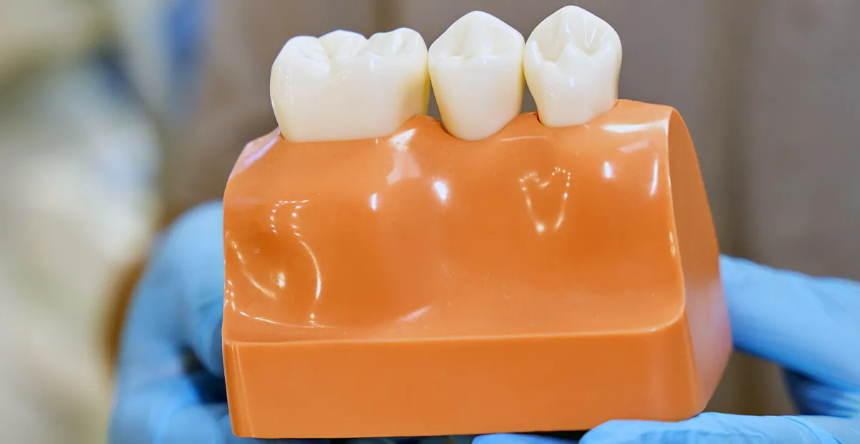 Hugo Carvalho Reabilitação Oral e Estética