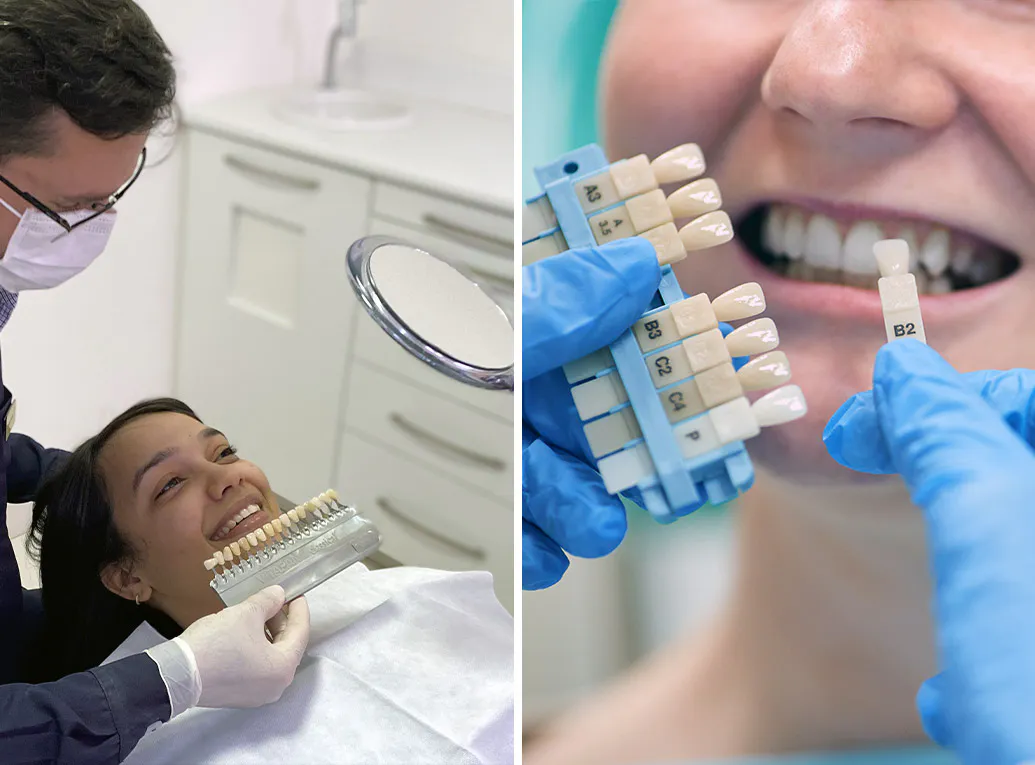 Hugo Carvalho Reabilitação Oral e Estética